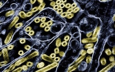 Suspected human bird flu case may be first in US in nine months