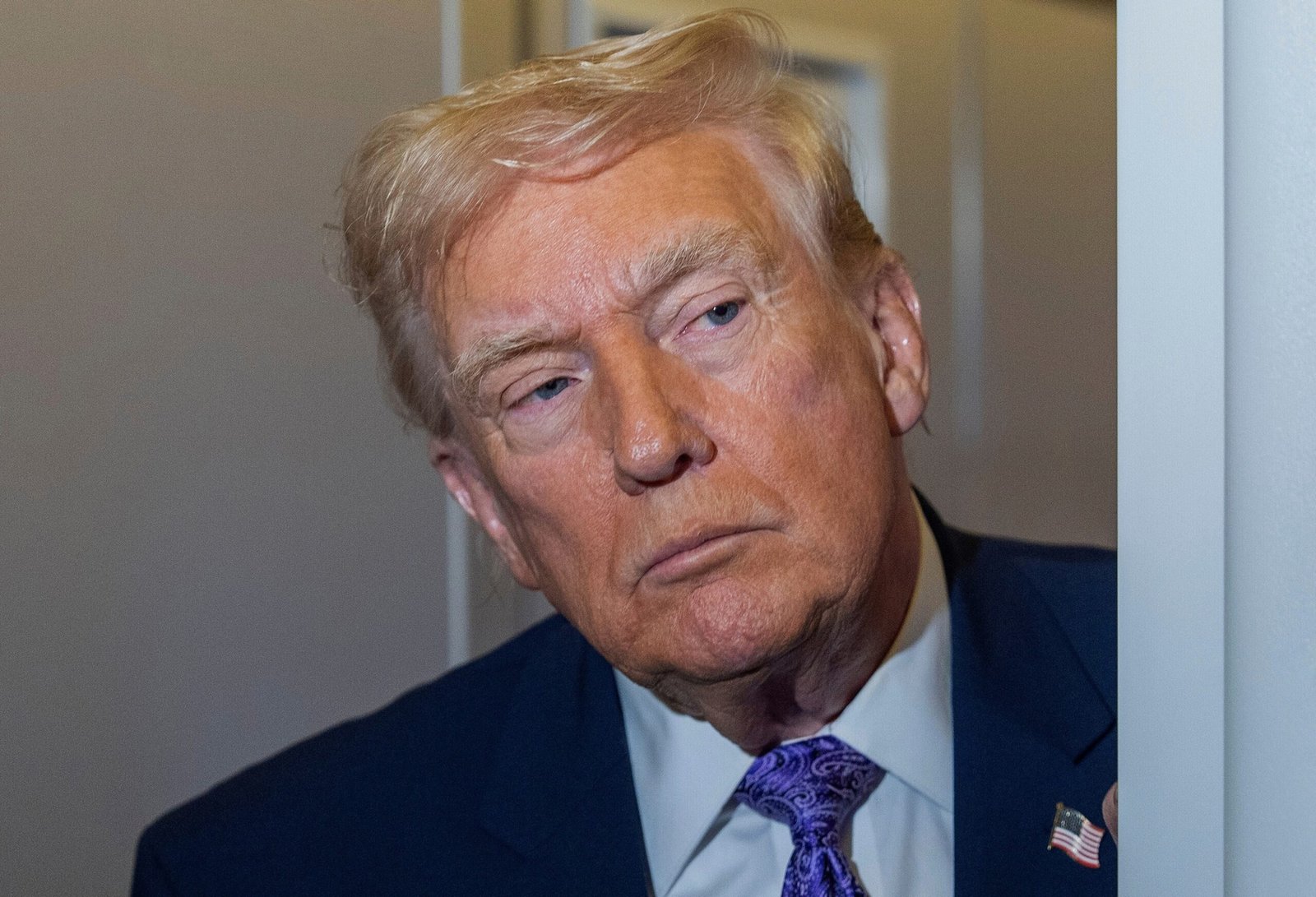 White House doctor says in memo that Trump's imaging test results were 'perfectly normal'